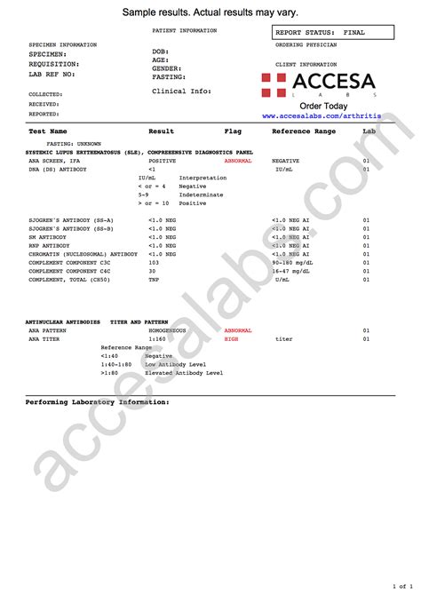 elisa test lupus|lupus blood test lab results.